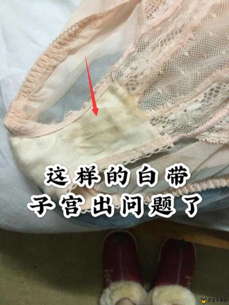 白带发黄有异味：警惕妇科炎症